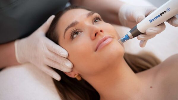 Microneedling Course Accredited by CPD international