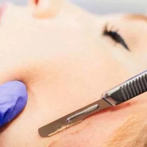 Dermaplaning One Day Course - Accredited by Beauty Guild